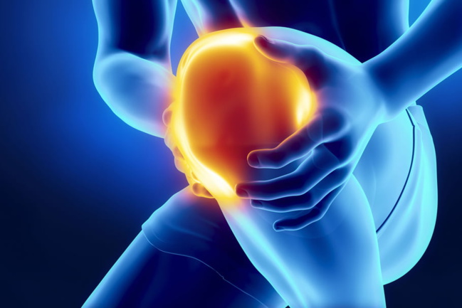 Remplacement du genou : des stéroïdes à haute dose sont préférables pour les patients présentant des niveaux élevés de douleur préopératoire Remplacement du genou : des stéroïdes à haute dose sont préférables pour les patients présentant des niveaux élevés de douleur préopératoire