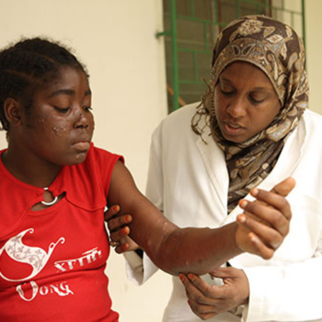 Lèpre, maladie infectieuse. Lèpre, maladie infectieuse.