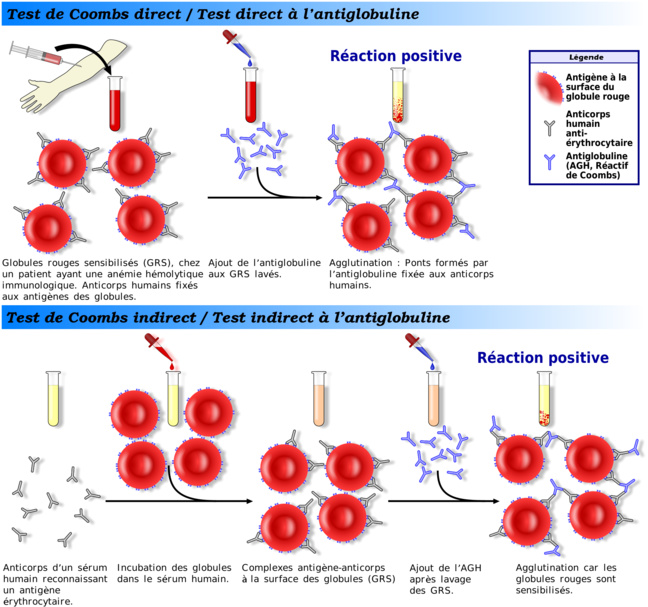 Les autoanticorps sont l’élément le plus prédictif d’un COVID long! Les autoanticorps sont l’élément le plus prédictif d’un COVID long!