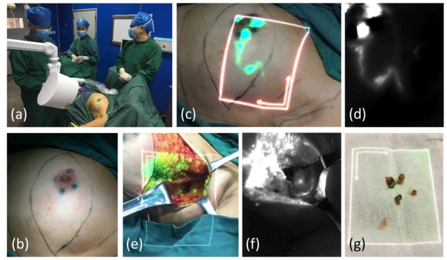 Innovation majeure en imagerie des cancers! Innovation majeure en imagerie des cancers!