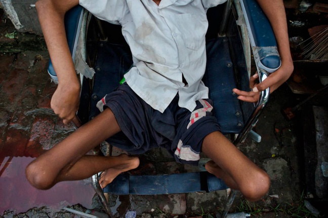 Un cas de polio sauvage détecté au Malawi, le premier en Afrique Un cas de polio sauvage détecté au Malawi, le premier en Afrique