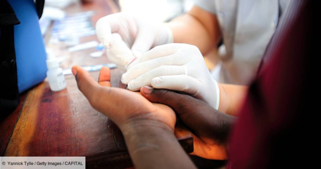 CROI 2022 — Une femme a guéri du VIH grâce à une nouvelle technique de greffe