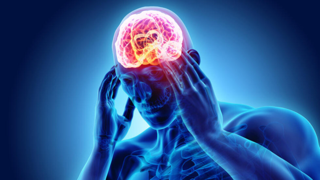 Migraine : le bénéfice prophylactique de l'érénumab confirmé en vie réelle