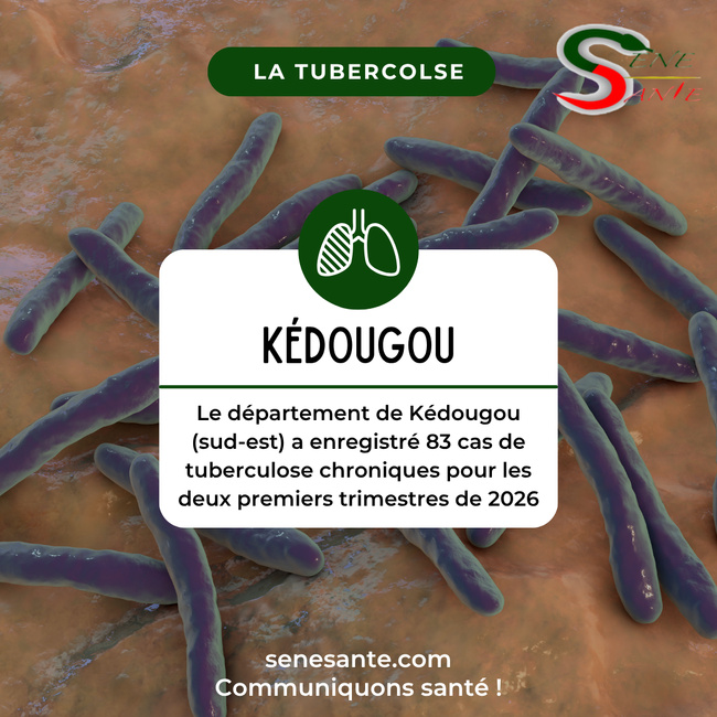 Le département de Kédougou (sud-est) a enregistré 83 cas de tuberculose chroniques pour les deux premiers trimestres de 2026 Le département de Kédougou (sud-est) a enregistré 83 cas de tuberculose chroniques pour les deux premiers trimestres de 2026