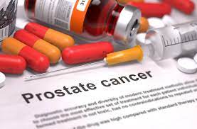 Cancer de la prostate : l’évaluation de la densité osseuse reste rare chez les patients plus âgés