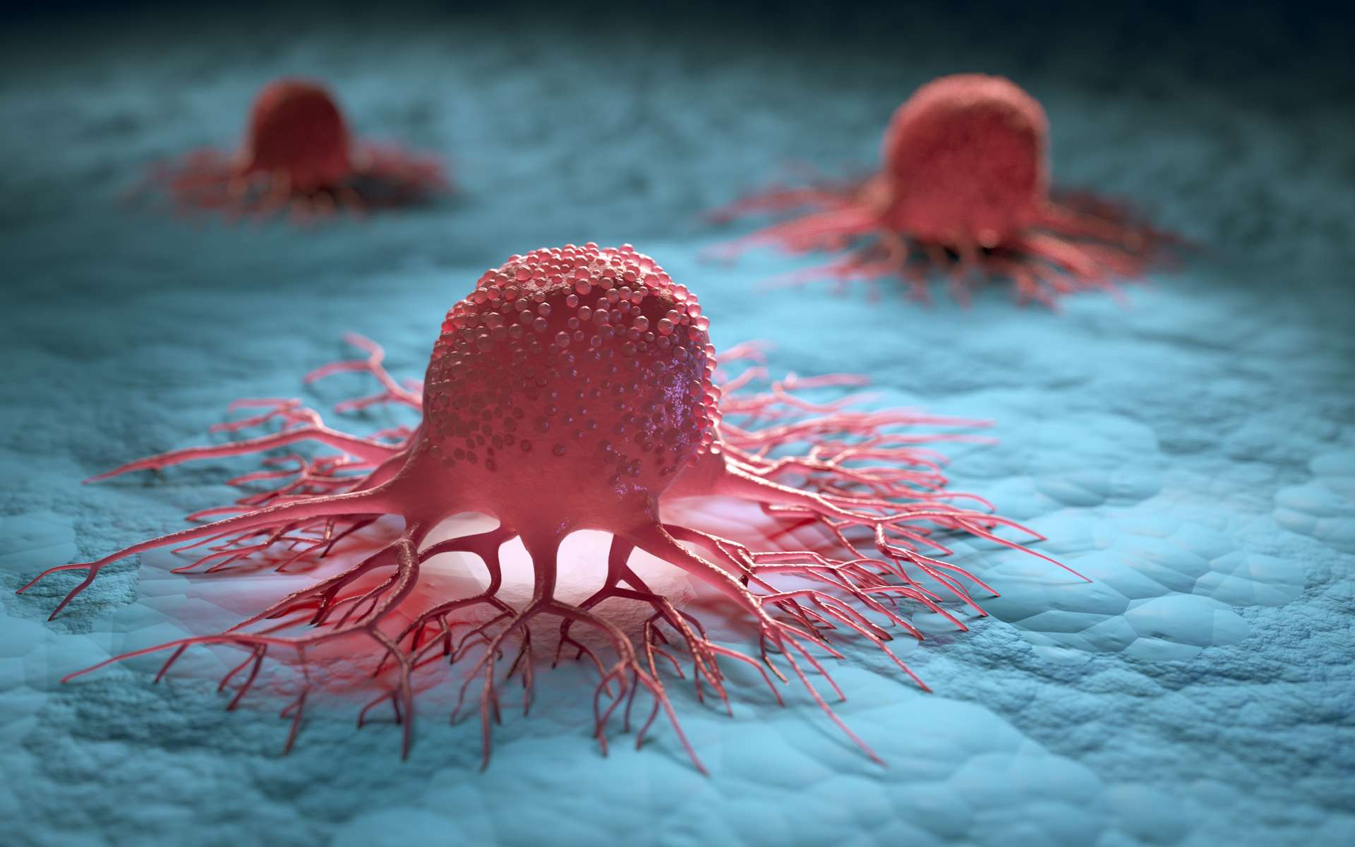 Une étude fournit de nouvelles informations sur le lien entre le régime occidental et le cancer colorectal
