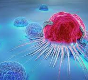 CBNPC avancé avec réarrangement de l’ALK : quelles sont les meilleures thérapies ciblées ?