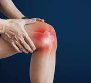 SFR 2021 - Recommandations 2021 pour la prise en charge non pharmacologique des malades atteints de gonarthrose