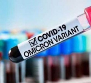 COVID19: Une forte hausse des nouvelles contaminations