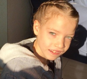 Hypercroissance dysharmonieuse : des résultats encourageants autour d'un traitement testé sur deux nourrissons