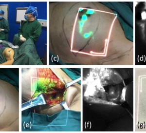 Innovation majeure en imagerie des cancers!