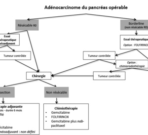 Cancer du pancréas : l’inhibition de l’angiotensine est associée à un bénéfice de survie significatif