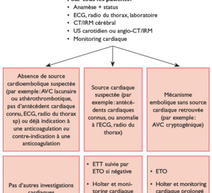 Un essai évalue les risques et les bénéfices du TEV pour les AVC par infarctus de grande taille