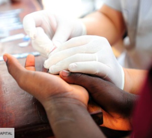 CROI 2022 — Une femme a guéri du VIH grâce à une nouvelle technique de greffe