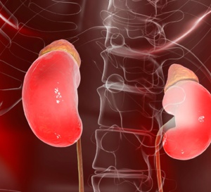 Quels sont les patients les plus à risque d’insuffisance rénale chronique après un épisode aigu ?