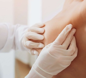 Mini quiz : 5 minutes – 5 questions pour savoir repérer les signes d’alarme du cancer du sein