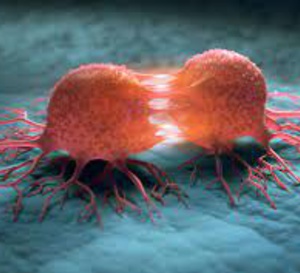 Cas clinique : une crise d'épilepsie chez un patient traité par immunothérapie pour adénocarcinome