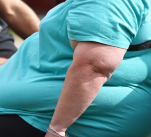 ADA 2022 — L’obésité est-elle la cible thérapeutique primaire dans le diabète de type 2 ?