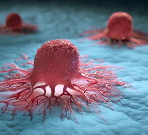 L’apnée du sommeil favorise la survenue et la progression du cancer