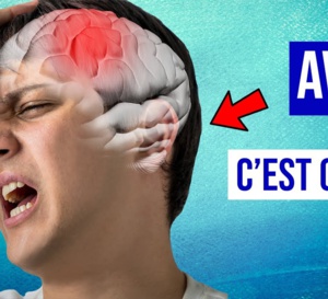 Impact majeur de la crise sanitaire sur la prise en charge des AVC