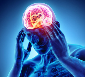 Migraine : le bénéfice prophylactique de l'érénumab confirmé en vie réelle