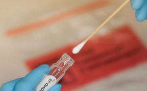 Covid-19 : L'Oms veut renforcer le dépistage dans 8 pays dont le Sénégal Covid-19 : L'Oms veut renforcer le dépistage dans 8 pays dont le Sénégal