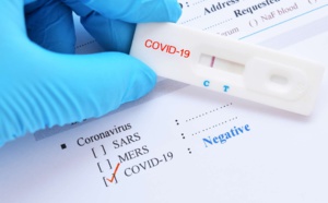 COVID-19 : les résultats d’une étude soulignent un risque d’infection grave par le SARS-CoV-2 chez les personnes infectées par le VIH qui présentent des comorbidités liées à l’âge Wang H &amp; al.  Clinical Summary  3 déc. 2021     À retenir  Les per