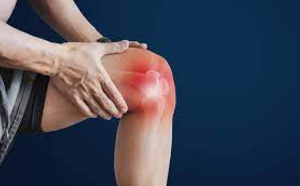 SFR 2021 - Recommandations 2021 pour la prise en charge non pharmacologique des malades atteints de gonarthrose