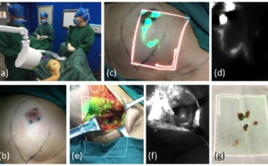 Innovation majeure en imagerie des cancers!