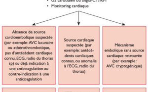 Un essai évalue les risques et les bénéfices du TEV pour les AVC par infarctus de grande taille