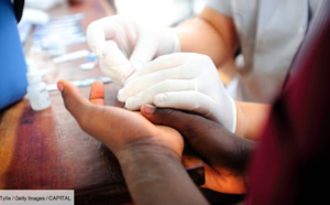 CROI 2022 — Une femme a guéri du VIH grâce à une nouvelle technique de greffe