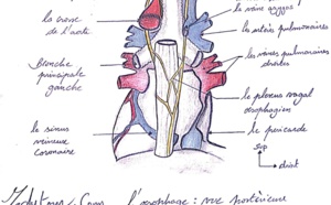 Œsophage de Barrett : quels sont les intervalles de surveillance optimaux après l’élimination endoscopique ?