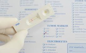 Cancer de la prostate : une biopsie négative conforte le choix d’une surveillance active