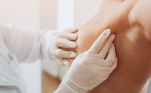 Mini quiz : 5 minutes – 5 questions pour savoir repérer les signes d’alarme du cancer du sein