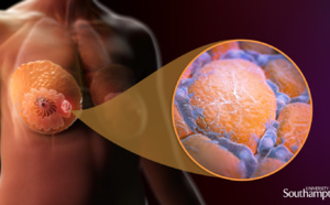 Cancer du sein : une consommation élevée de café et de thé améliore-t-elle les symptômes du cancer et la survie ?