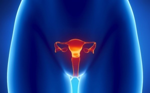 Cancer du col de l'utérus : qu'est ce qu'un frottis de dépistage ? Cancer du col de l'utérus : qu'est ce qu'un frottis de dépistage ?