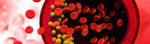 Dyslipidémie : 3 français sur 4 concernés. Vraiment ?