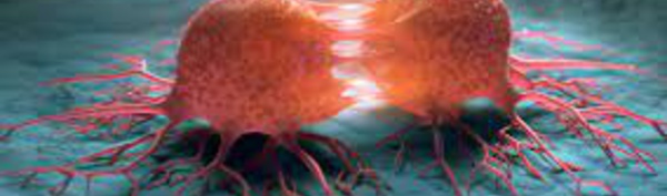 Cas clinique : une crise d'épilepsie chez un patient traité par immunothérapie pour adénocarcinome