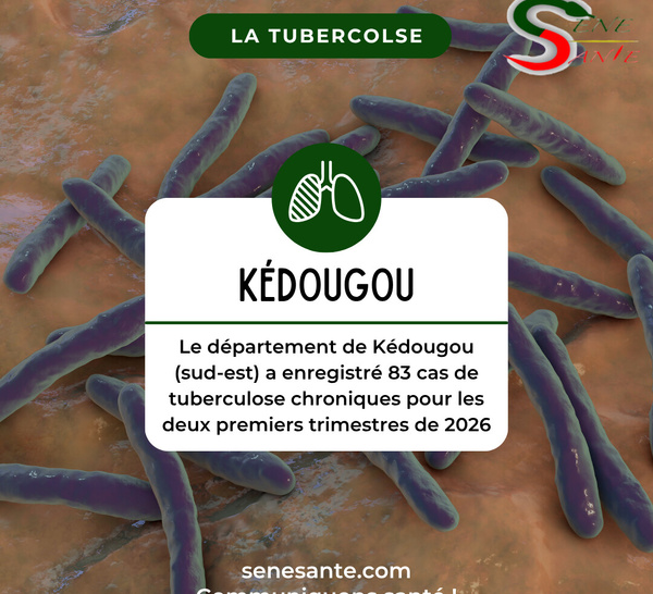 Le département de Kédougou (sud-est) a enregistré 83 cas de tuberculose chroniques pour les deux premiers trimestres de 2026