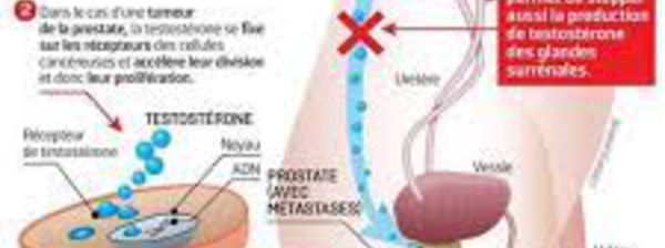 Cancer du sein : inhibiteur de l’aromatase en pré-ménopause, intérêt sous certaines conditions