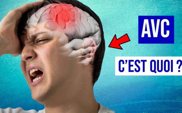 Impact majeur de la crise sanitaire sur la prise en charge des AVC