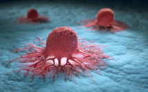 Le risque de thromboembolie veineuse est plus élevé en cas de cancer de la prostate