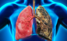 Quels sont les facteurs alimentaires qui influent sur le risque de cancer du poumon ? Une étude de 10 pays européens