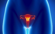 Cancer du col de l'utérus : qu'est ce qu'un frottis de dépistage ?