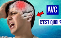 Impact majeur de la crise sanitaire sur la prise en charge des AVC