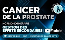Hormonothérapie et Cancer de la Prostate : bénéfices du traitement et gestion des effets secondaires.